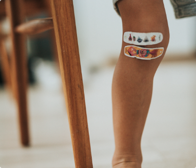 Leg